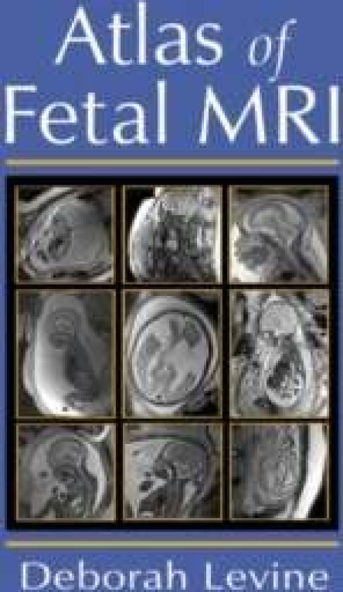 Atlas of Fetal MRI av Deborah (Beth Israel Deaconess Medical Center Boston MA USA) Levine