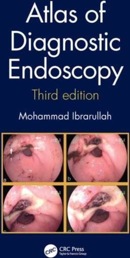 Atlas of Diagnostic Endoscopy, 3E av Mohammad (Apollo Hospitals India) Ibrarullah