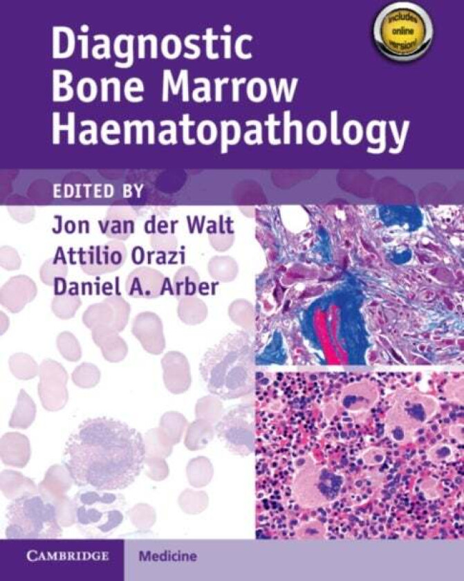 Diagnostic Bone Marrow Haematopathology Book with Online content av Jon van der Walt, Attilio Orazi, Daniel A. (University of Chicago) Arber
