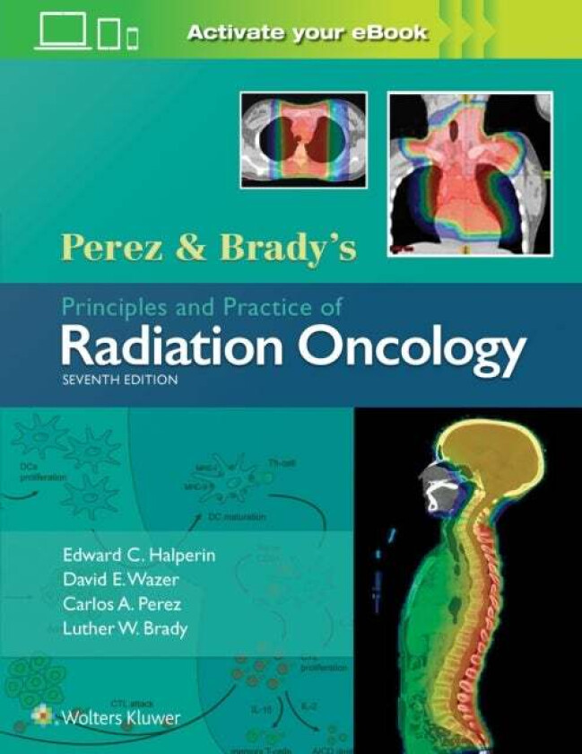 Perez & Brady's Principles and Practice of Radiation Oncology av Dr. Edward C. MD Halperin, Dr. David E. MD Wazer, Dr. Carlos A. MD Perez, Dr
