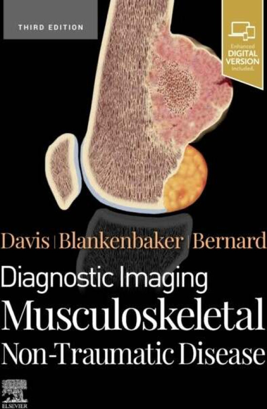 Diagnostic Imaging: Musculoskeletal Non-Traumatic Disease av Kirkland W. (Professor of Radiology Musculoskeletal Imaging and Intervention Department o