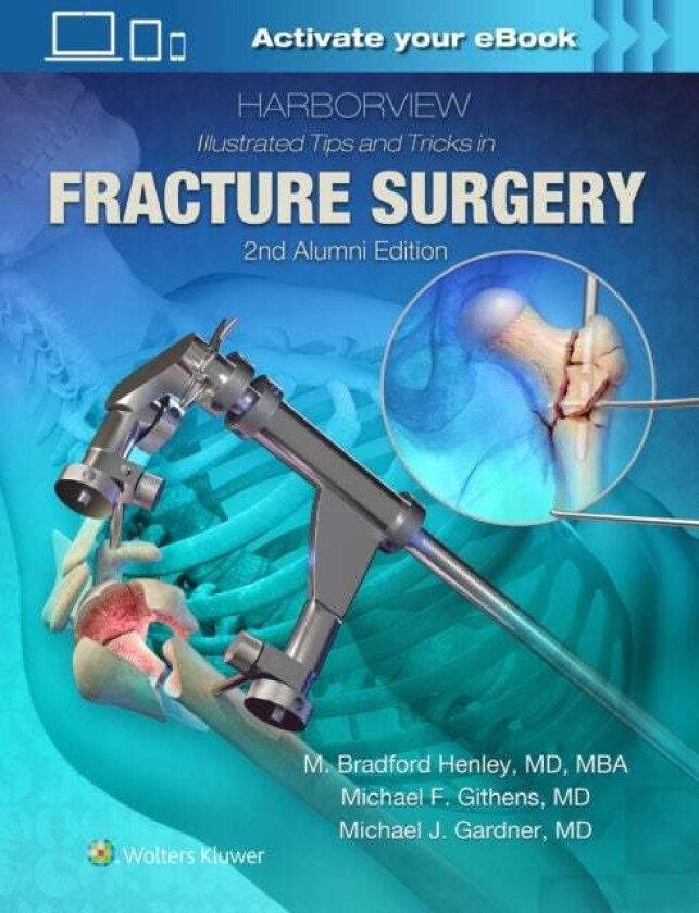 Harborview Illustrated Tips and Tricks in Fracture Surgery av M. Henley