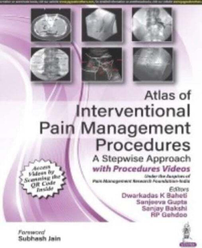 Atlas of Interventional Pain Management Procedures av Dwarkadas K Baheti, Sanjeeva Gupta, Sanjay Bakshi, RP Gehdoo