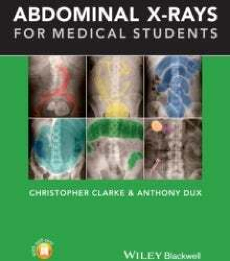 Abdominal X-rays for Medical Students av Christopher (Nottingham University Hospitals) Clarke, Anthony (University Hospitals of Leicester) Dux