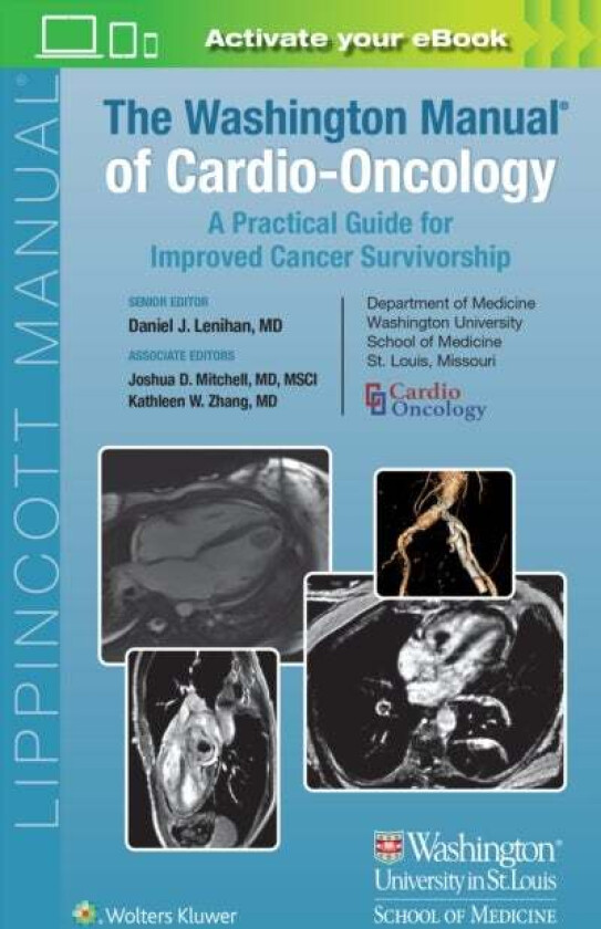 The Washington Manual of Cardio-Oncology