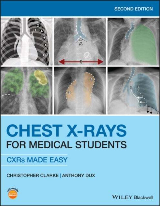Chest X-Rays for Medical Students av Christopher (ST2 Clinical Radiology Trainee at Nottingham University Hospitals and Honorary Lecturer in Human Ana