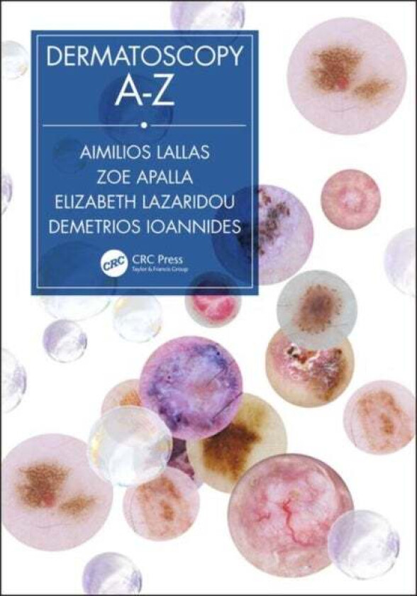 Dermatoscopy A-Z av Aimilios Lallas, Zoe Apalla, Elizabeth Lazaridou, Dimitrios Ioannides