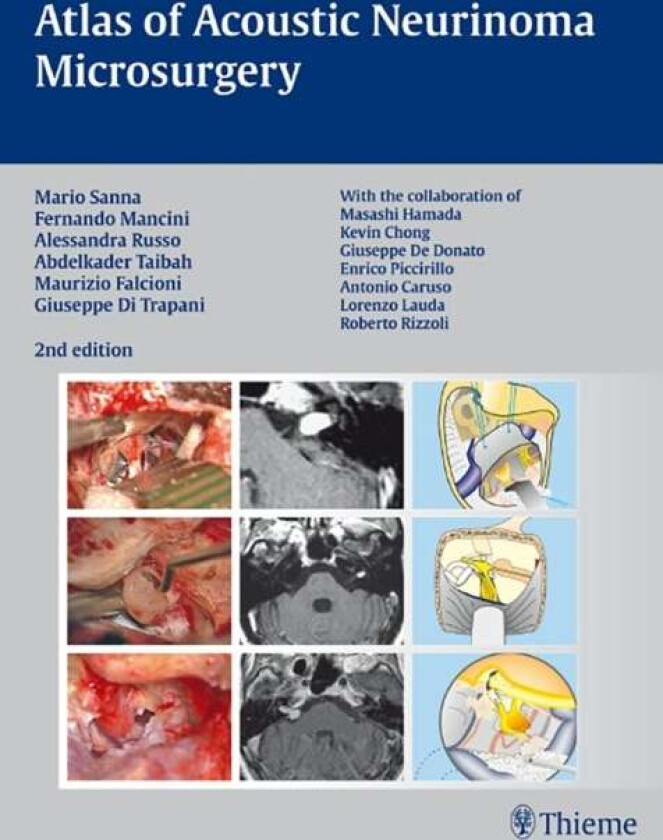 Atlas of Acoustic Neurinoma Microsurgery av Mario Sanna, Fernando Mancini, Alessandra Russo, Abdelkader Taibah, Maurizio Falcioni, Giuseppe Di Trapani