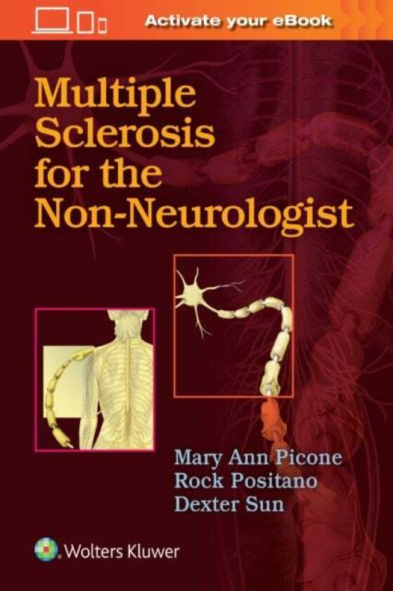 Multiple Sclerosis for the Non-Neurologist av Mary Ann Picone