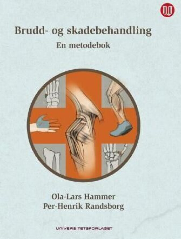 Brudd- og skadebehandling av Ola-Lars Hammer, Per-Henrik Randsborg