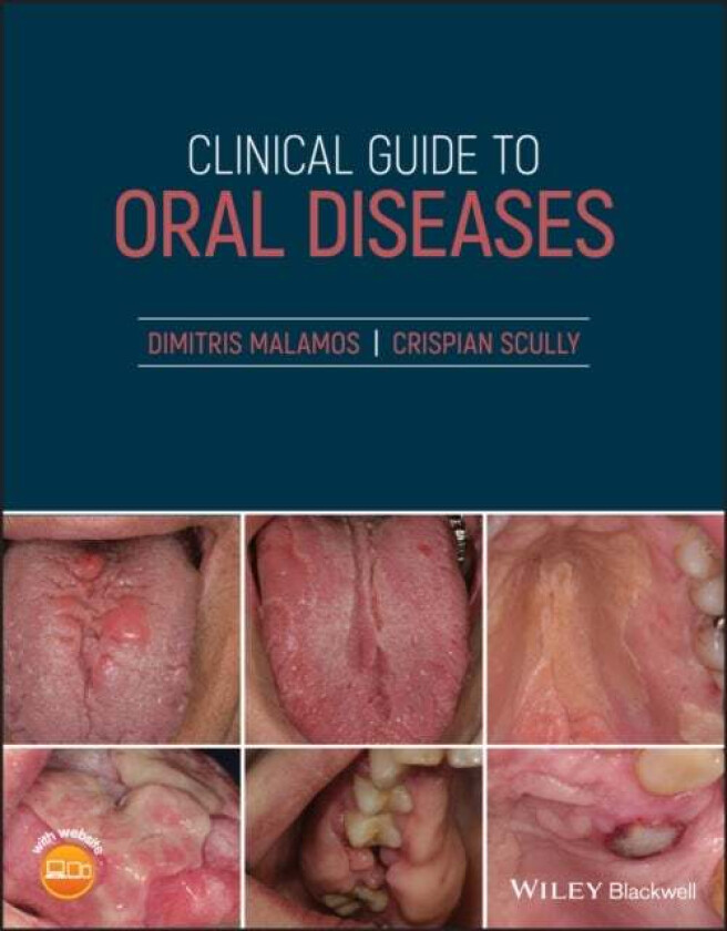 Clinical Guide to Oral Diseases av Dimitris Malamos, Crispian CBE (University College London) Scully