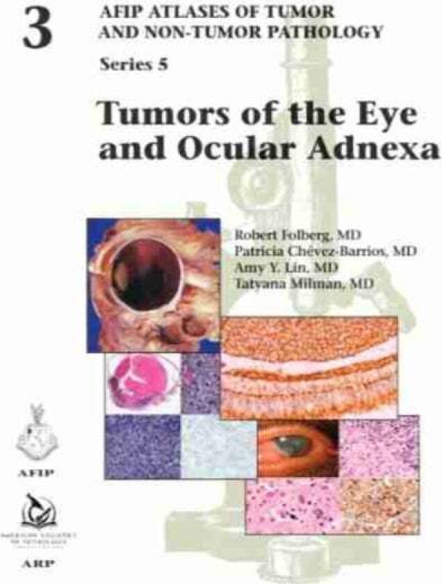 Tumors of the Eye and Ocular Adnexa av Robert Folberg, Patricia Chevez-Barrios, Amy Y. Lin, Tatyana Millman