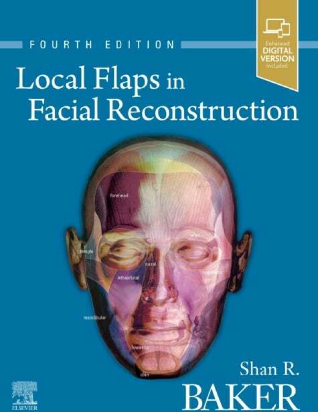 Local Flaps In Facial Reconstruction Av Shan R. (Professor And Chief Section Of Facial Plastic And Reconstructive Surgery Director Center For Facial C