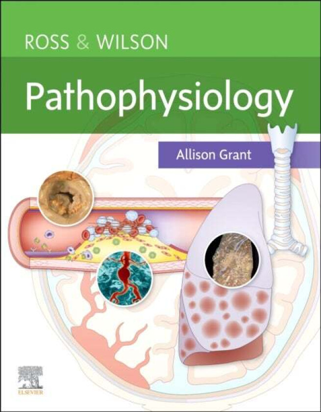 Ross & Wilson Pathophysiology av Allison BSc PhD RGN (Department of Biological and Biomedical Sciences Glasgow Caledonian University Glasgow UK) G
