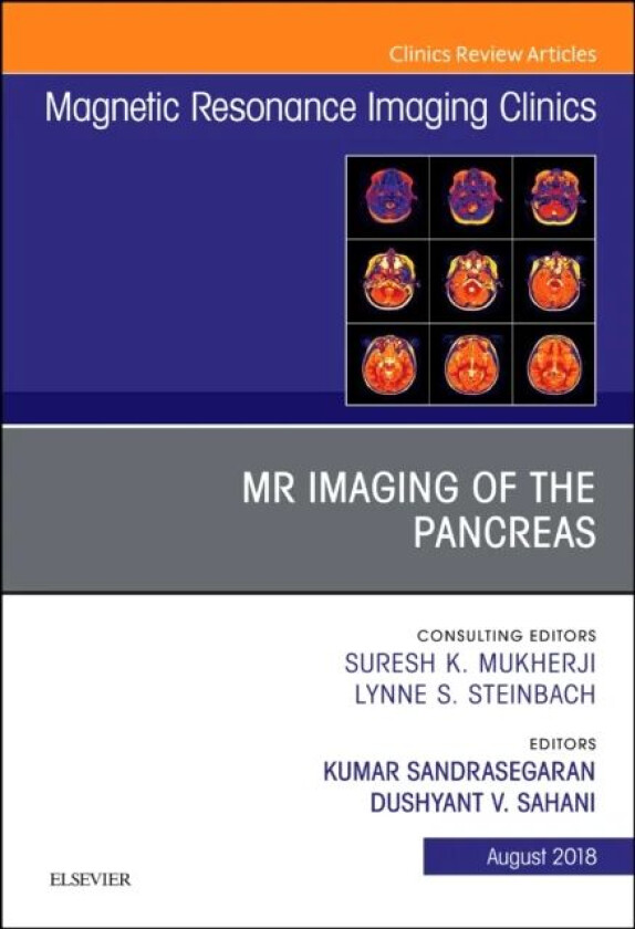 MR Imaging of the Pancreas, An Issue of Magnetic Resonance Imaging Clinics of North America av Kumar MD (Department of Radiology and Imaging Sciences