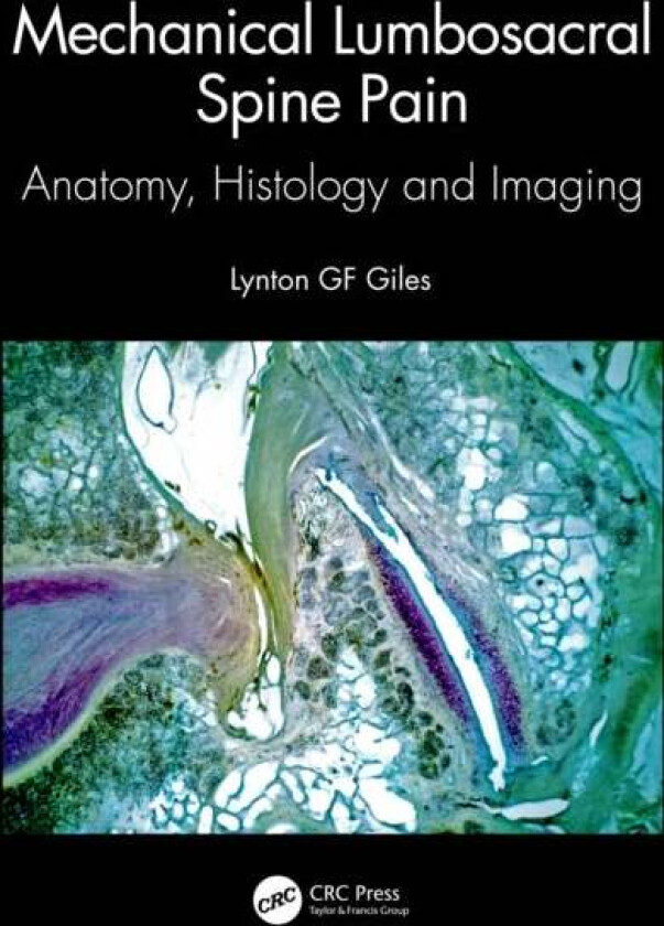 Mechanical Lumbosacral Spine Pain av Lynton GF (James Cook University Queensland Australia) Giles