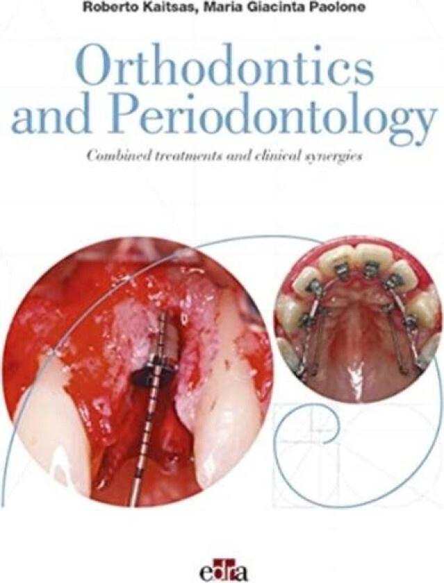 Orthodontics and Periodontology av Roberto Kaitsas, Maria Giacinta Paolone