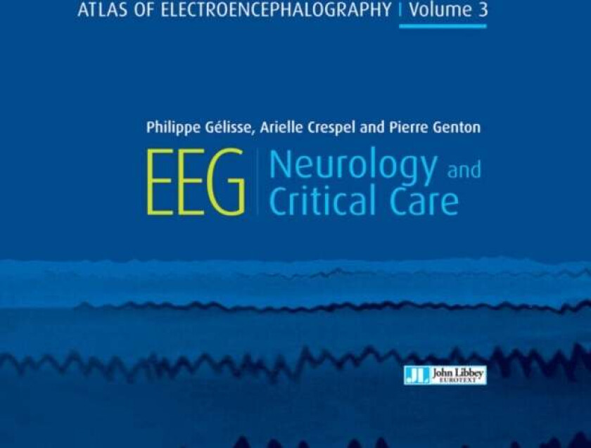 Atlas of Electroencephalography Volume 3 av Dr Philippe Gelisse, Dr Arielle Crespel, Pierre Genton