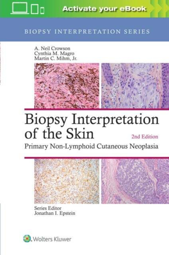 Biopsy Interpretation of the Skin av A. Neil Crowson, Cynthia M. Magro