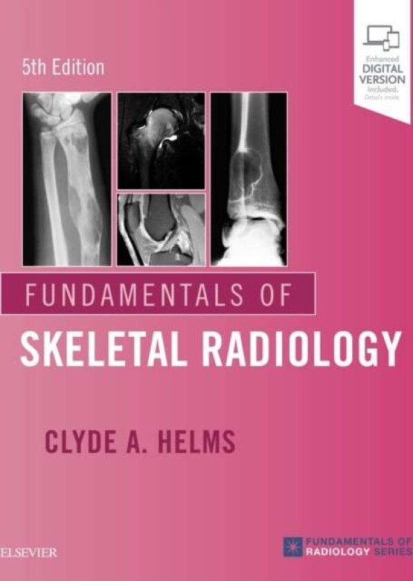 Fundamentals of Skeletal Radiology av Clyde A. (Professor of Radiology and Orthopaedic Surgery Deparment of Radiology Duke University School of Medici