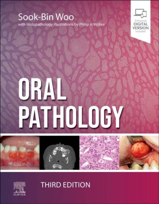 Bilde av Oral Pathology av Sook-Bin (Associate Professor Harvard School of Dental Medicine Brigham and Women's Hospital Dental Services Boston Woo, Center