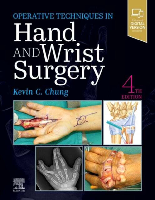Operative Techniques: Hand and Wrist Surgery av Kevin C. (Charles B.G. De Nancrede Professor in Surgery Section of Plastic Surgery Chung, Associate Di