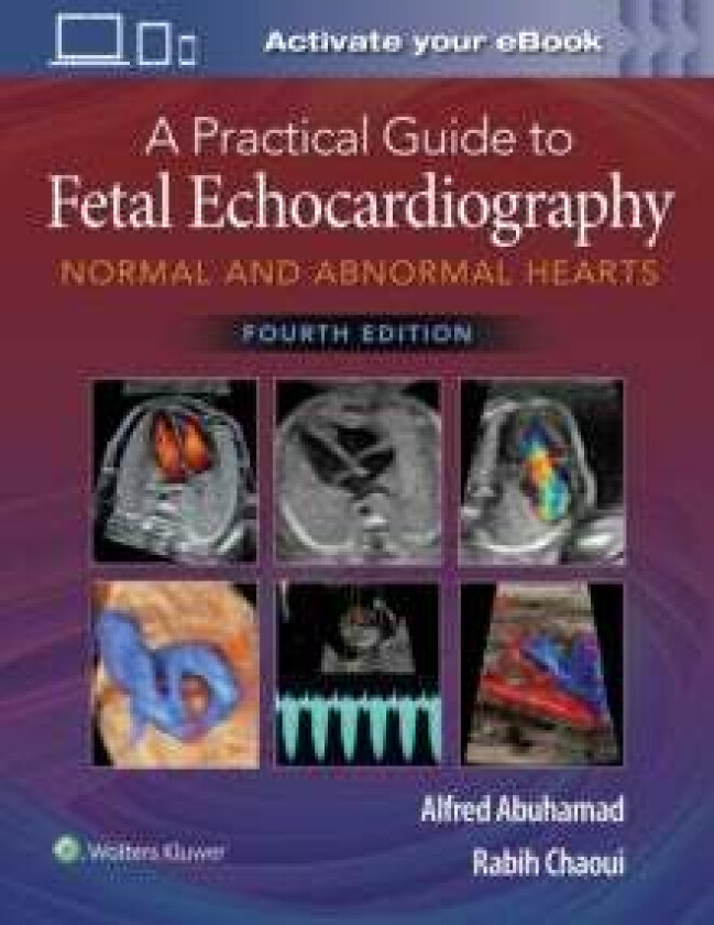 A Practical Guide to Fetal Echocardiography av Alfred Z. Abuhamad, Rabih Chaoui