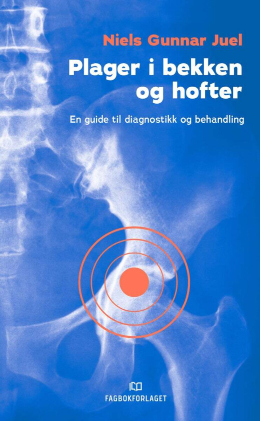 Plager i bekken og hofter av Niels Gunnar Juel