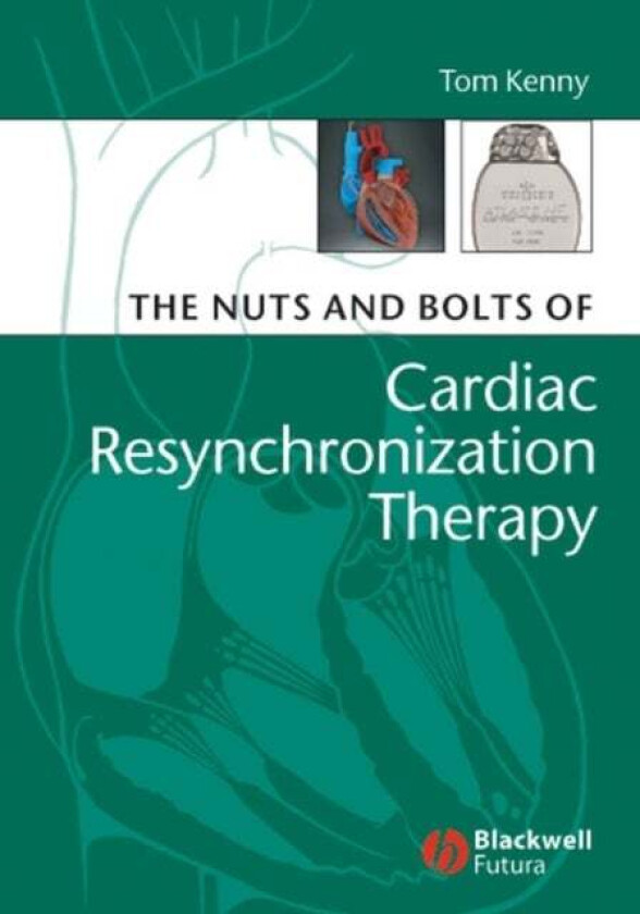 The Nuts and Bolts of Cardiac Resynchronization Therapy av Tom (St. Jude Medical Austin Texas) Kenny