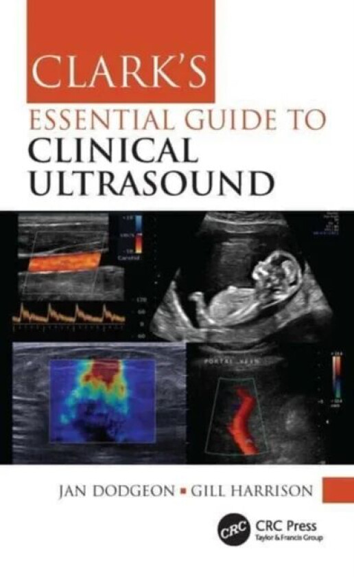 Clark's Essential Guide to Clinical Ultrasound av Jan Dodgeon, Gill Harrison