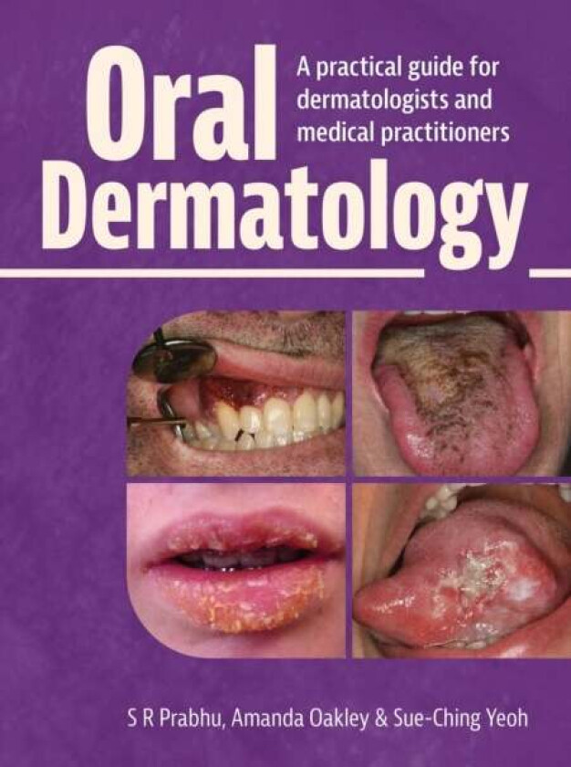 Oral Dermatology av S.R. BDS MDS (Oral Path) FFDRCSIre (Oral Med) FDS RCS (Eng) FDS RCS (Edin) FDSRCPS (Glas) FFGDP RCS (Honorary Associate Professor