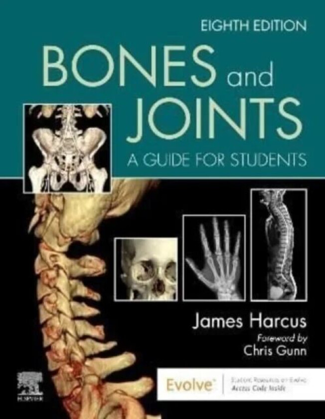 Bones and Joints av James (Lecturer in Diagnostic Imaging University of Leeds UK) Harcus
