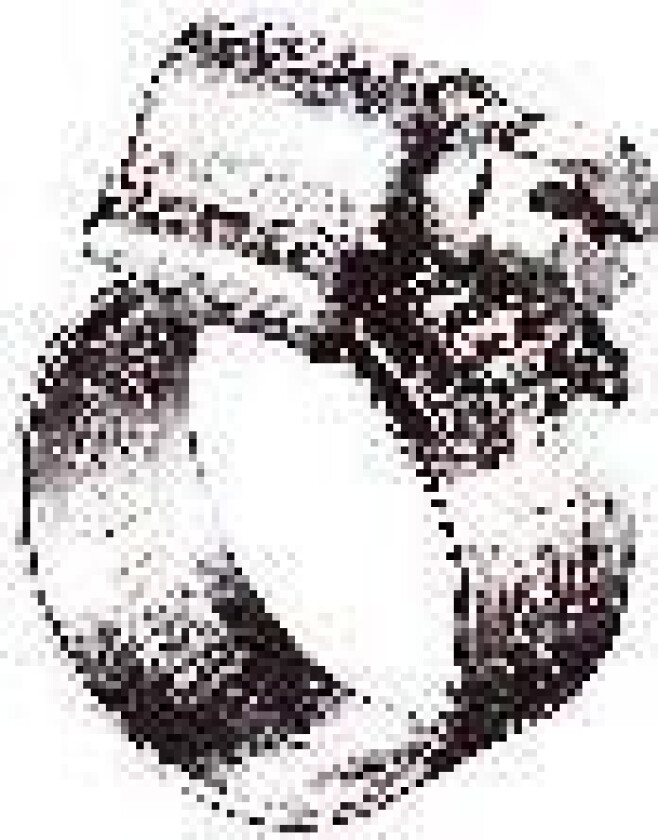 Slangeklemme aba nova 11-17 w5