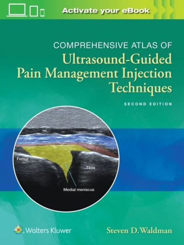 Bilde av Comprehensive Atlas of Ultrasound-Guided Pain Management Injection Techniques av Steven Waldman