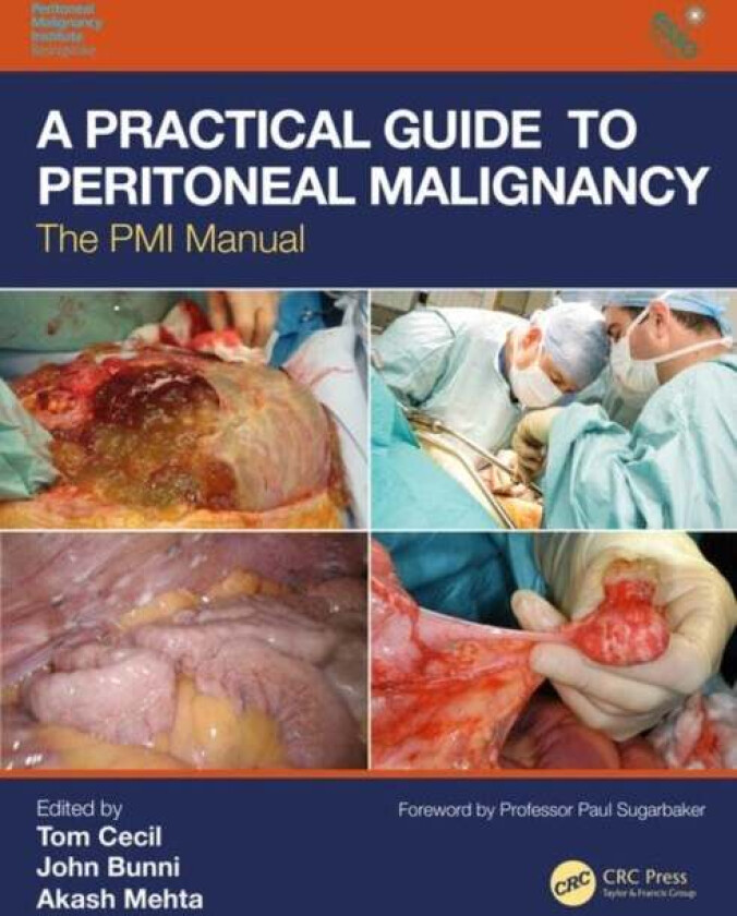 A Practical Guide To Peritoneal Malignancy