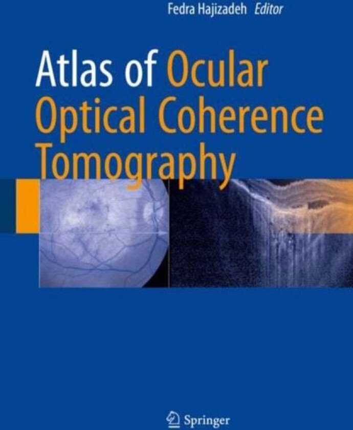 Atlas Of Ocular Optical Coherence Tomography