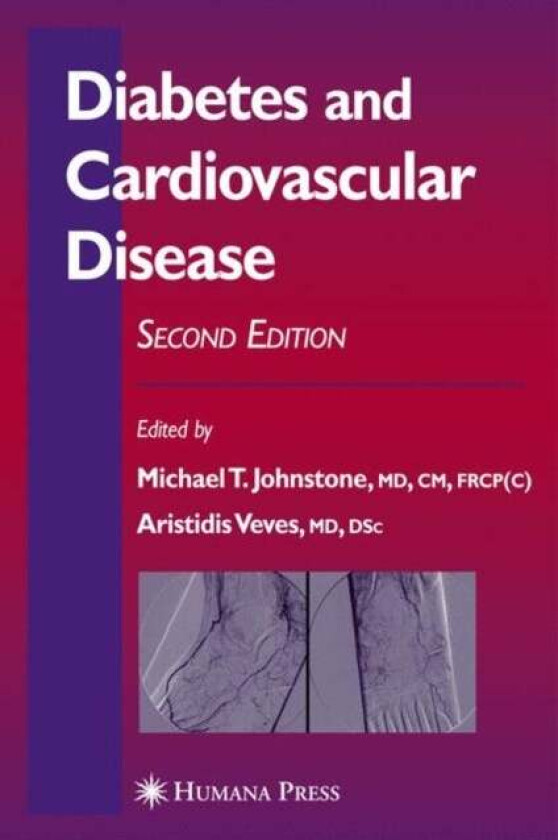 Diabetes And Cardiovascular Disease