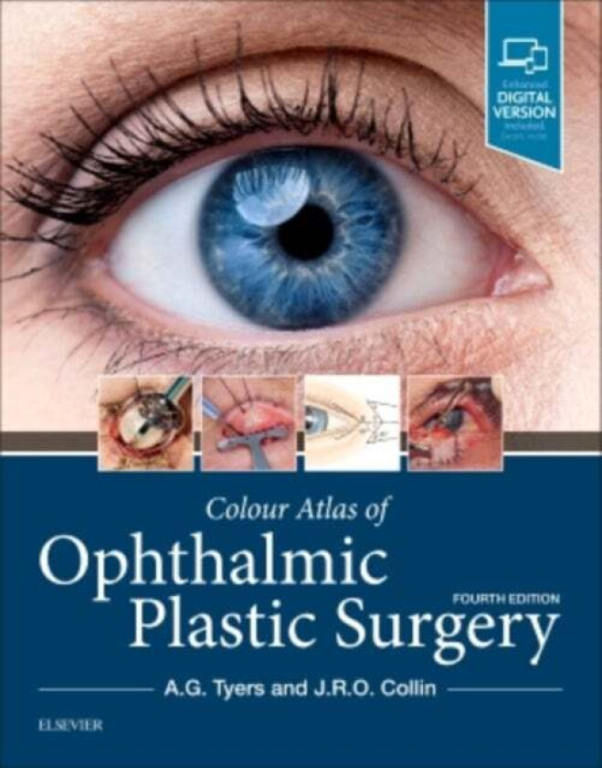 Colour Atlas Of Ophthalmic Plastic Surgery Av Anthony G. (Consultant In Ophthalmic Surgeon Salisbury District Hospital Salisbury Uk And Moorfields Eye