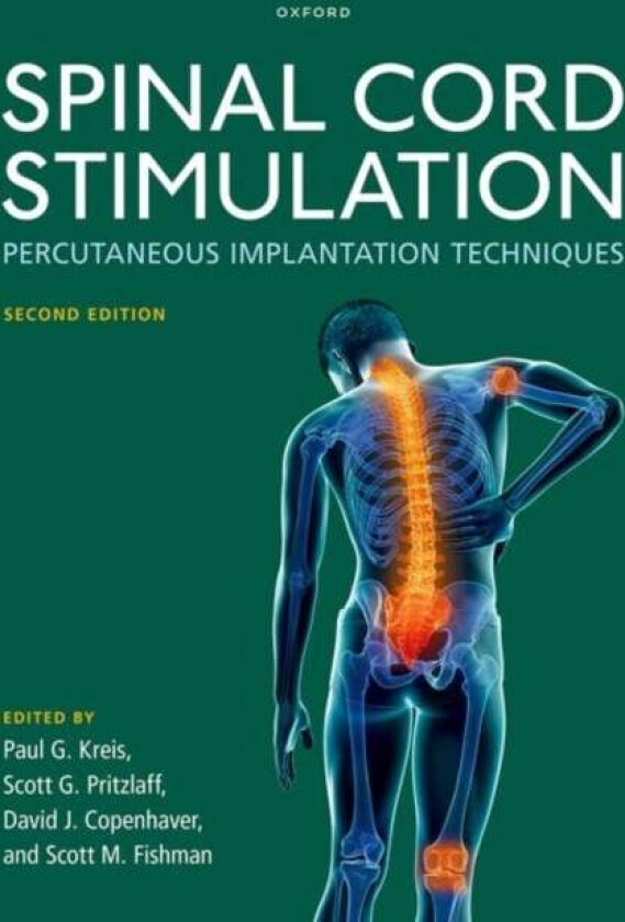 Spinal Cord Stimulation