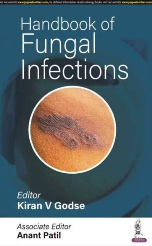 Handbook of Fungal Infections av Kiran V Godse, Anant Patil