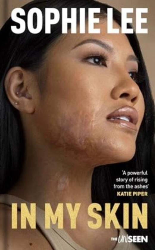 In My Skin av Sophie Lee