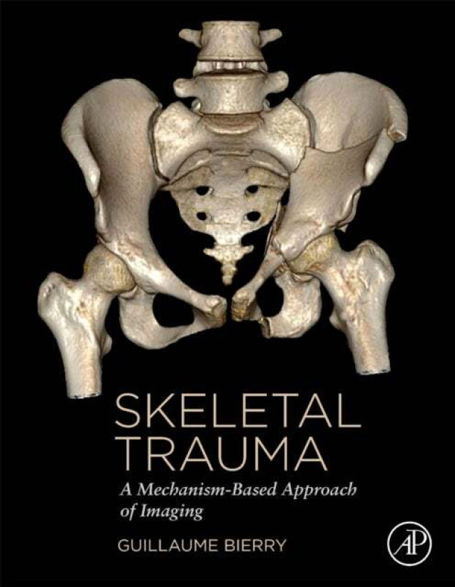 Skeletal Trauma av Guillaume (University Hospital Strasbourg France) Bierry