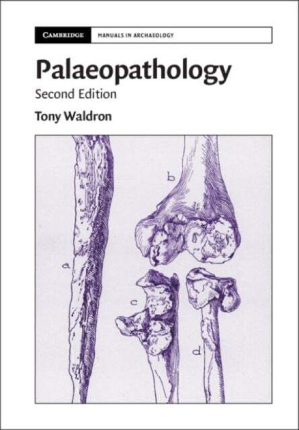 Palaeopathology av Tony (University College London) Waldron