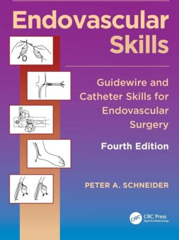 Endovascular Skills av Peter A. (Division of Vascular Therapy Kaiser Foundation Hospital Honolulu Hawaii USA) Schneider