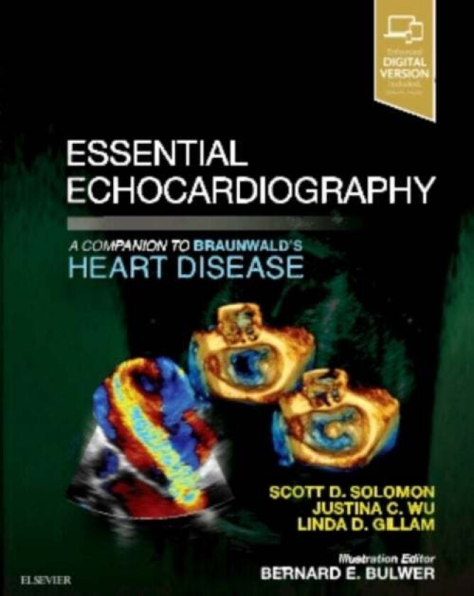 Essential Echocardiography av Scott D MD Solomon, Justina Wu, Linda D Gillam