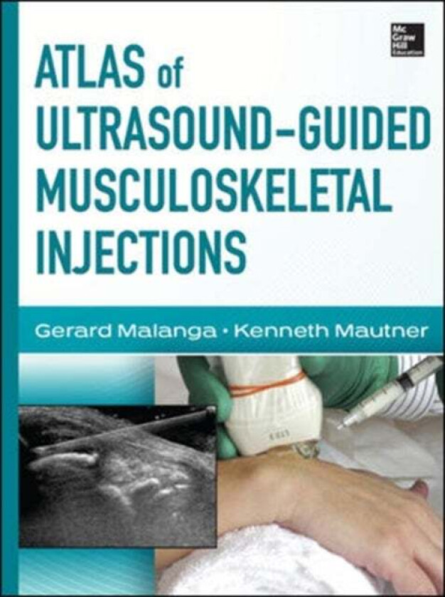 Atlas of Ultrasound-Guided Musculoskeletal Injections av Gerard Malanga, Kenneth Mautner