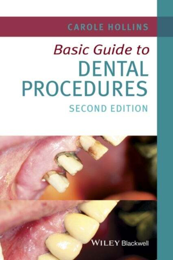 Basic Guide to Dental Procedures av Carole (Dental practitioner UK) Hollins