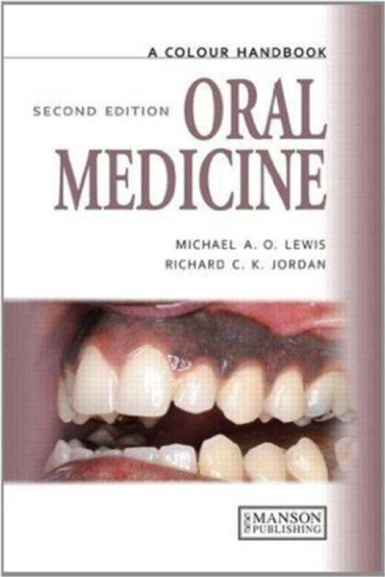 Oral Medicine av Michael (University of Central Lancashire UK) Lewis, Richard Jordan