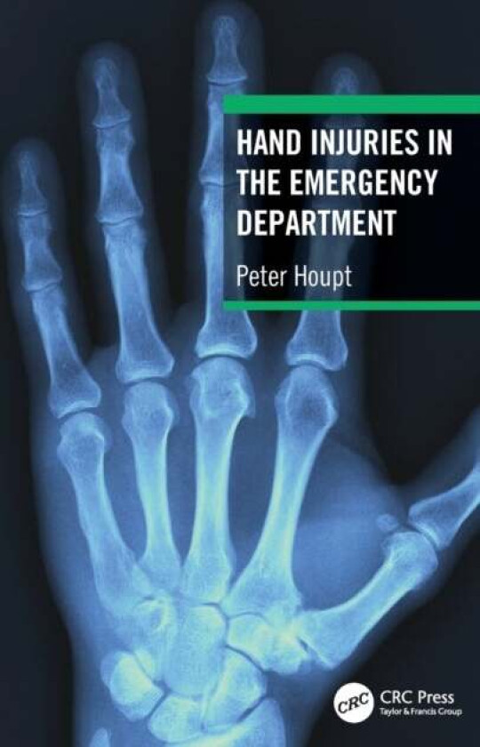 Hand Injuries in the Emergency Department av Peter (Isala Clinics Zwolle The Netherlan Houpt