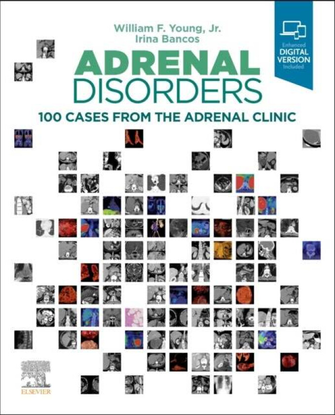 Adrenal Disorders av William F. (Division of Endocrinology Diabetes Metabolism and Nutrition Tyson Family Endocrinology Clinical Professor Young, Mayo